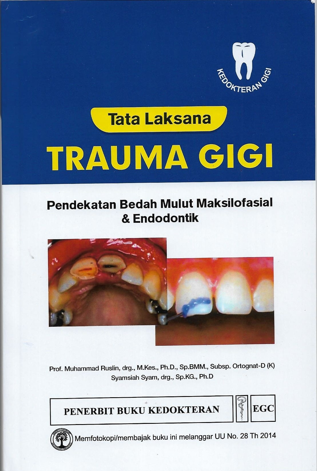 Tata Laksana Trauma Gigi Pendekatan Bedah Mulut