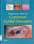 DIAGNOSTIC ATLAS OF COMMON EYELID DISEASES