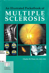 AN ILLUSTRATED POCKETBOOK  OF MULTIPLE SCLEROSIS