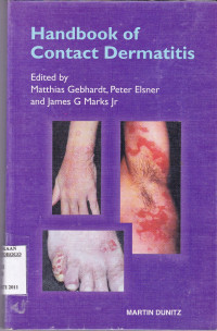 HANDBOOK OF CONTACT DERMATITIS