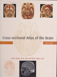 CROSS-SECTIONAL ATLAS OF THE BRAIN