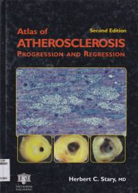 ATLAS OF ATHEROSCLEROSIS PROGRESSION AND REGRESSION