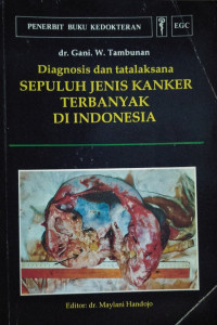 DIAGNOSIS DAN TATALAKSANA SEPULUH JENIS KANKER TERBANYAK DI INDONESIA