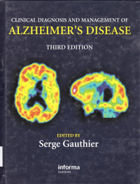 CLINICAL DIAGNOSIS AND MANAGEMENT OF ALZHEIMER'S DISEASE